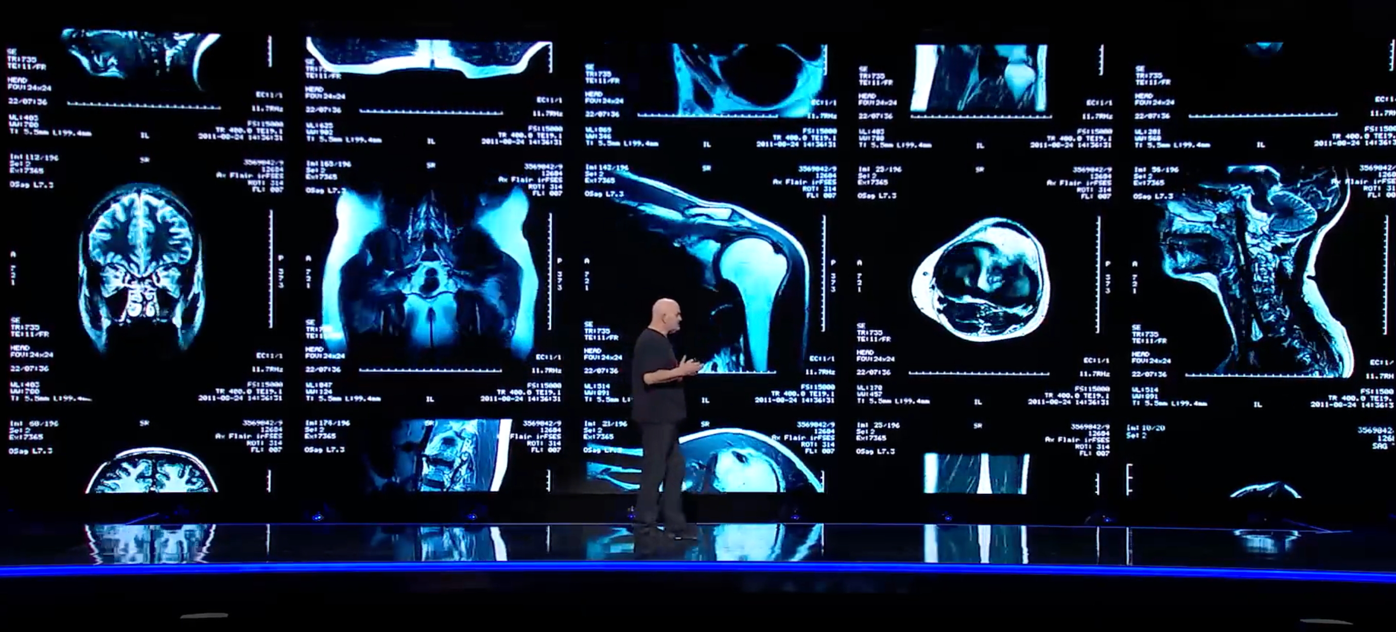 360 degree view diagnosis AWS reInvent2023 Werner Vogels keynote